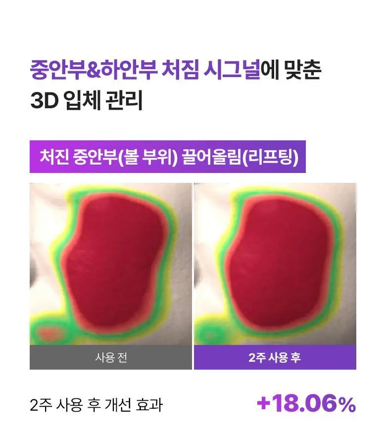 [입체탄력마스크] 바이오힐보 프로바이오덤 3D 리프팅 크림 마스크 [1매/다매입] 상세페이지 16